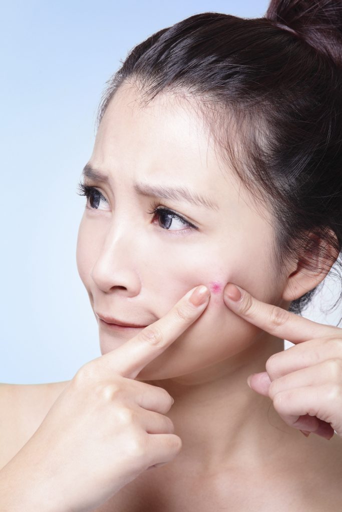 6 main causes of acne